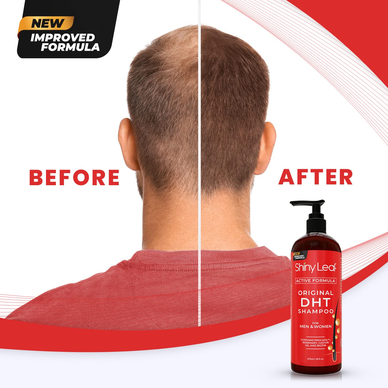 Blocker Anti Hair Loss Shampoo Conditioner Set Biotin