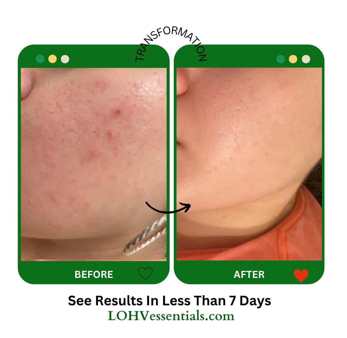 Premium Vegan Hydrating Facial Cleanser Oil Control Gentle Skin Wash